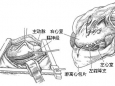 我院心胸外科血管外科妙手解决心脏顽疾，获患者点赞